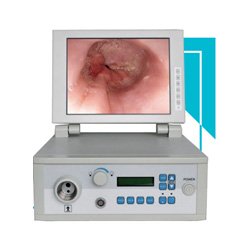 Endoscopia
