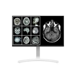 Monitores Diagnostico